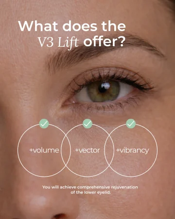 11. Instagram design - Action