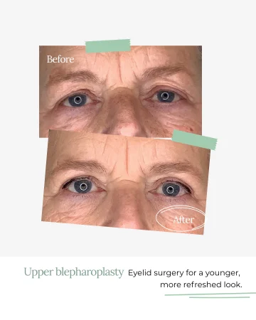 8. Social media design - Before _ After